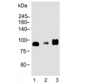 Western blot testing of human 1) LNCaP, 2) U-2 OS and 3) MCF7 cell lysate with CD276 antibody. Expected molecular weight: 57-110 kDa depending on level of glycosylation.