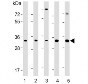Western blot testing of 1) human liver, 2) human pancreas, 3) human HeLa, 4) mouse eyeball and 5) mouse pancreas lysate with SFRP5 antibody. Predicted molecular weight ~36 kDa.