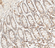 IHC testing of FFPE human colon tissue with SFRP5 antibody. HIER: steam section in pH9 EDTA for 20 min and allow to cool prior to staining.