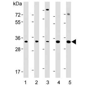 Western blot testing of 1) human liver, 2) human pancreas, 3) human HeLa, 4) mouse eyeball and 5) mouse pancreas lysate with SFRP5 antibody. Predicted molecular weight ~36 kDa.