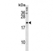 Western blot testing of mouse NIH 3T3 cell lysate with Bcl-W antibody. Predicted moleuclar weight ~21 kDa.
