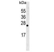 Western blot testing of human HL60 cell lysate with Bcl-W antibody. Predicted moleuclar weight ~21 kDa.