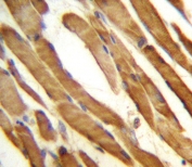 IHC testing of FFPE human skeletal muscle tissue with MCT10 antibody. HIER: steam section in pH6 citrate buffer for 20 min and allow to cool prior to staining.