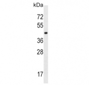 Western blot testing of human K562 cell lysate with MCT10 antibody. Predicted molecular weight ~55 kDa.