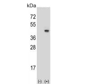 Western blot testing of 1) non-transfected and 2) transfected 293 cell lysate with Synaptophysin antibody.