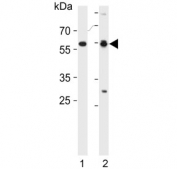 Western blot testing of 1) human HL60 and 2) mouse testis lysate with RAR alpha antibody. Predicted molecular weight ~51 kDa.