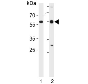 Western blot testing of 1) human HL60 and 2) mouse testis lysate with RAR alpha antibody. Predicted molecular weight ~51 kDa.