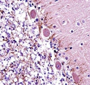 IHC testing of FFPE mouse cerebellum tissue with RAR alpha antibody. HIER: steam section in pH6 citrate buffer for 20 min and allow to cool prior to staining.