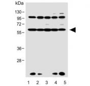 Western blot testing of human 1) HL60, 2) MCF7, 3) HepG2, 4) HeLa and 5) T-47D cell lysate with RAR alpha antibody. Predicted molecular weight ~51 kDa.