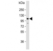 Western blot testing of human HepG2 cell lysate with Cadherin 4 antibody. Expected molecular weight: 100-140 kDa depending on glycosylation level.
