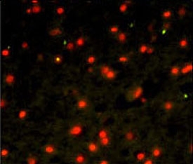 Immunofluorescent staining of human brain tissue with Cadherin 4 antibody (green) and Propidium iodide (red).