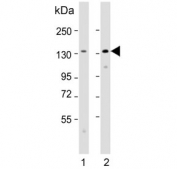 Western blot testing of human 1) A431 and 2) SH-SY5Y cell lysate with Cadherin 4 antibody. Expected molecular weight: 100-140 kDa depending on glycosylation level.