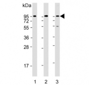 Western blot testing of human 1) HeLa, 2) MCF7 and 3) SH-SY5Y cell lysate with DAG1 antibody. Predicted molecular weight ~97 kDa.