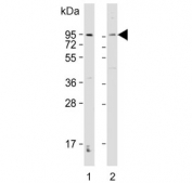 Western blot testing of 1) human SH-SY5Y and 2) mouse NIH 3T3 cell lysate with DAG1 antibody. Predicted molecular weight ~97 kDa.