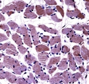 IHC testing of FFPE human skeletal muscle tissue with DAG1 antibody. HIER: steam section in pH6 citrate buffer for 20 min and allow to cool prior to staining.