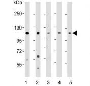 Western blot testing of human 1) HeLa, 2) HepG2, 3) A375, 4) K562 and 5) mouse liver lysate with IDE antibody. Predicted molecular weight ~118 kDa.