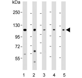 Western blot testing of human 1) HeLa, 2) HepG2, 3) A375, 4) K562 a
