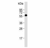 Western blot testing of human liver lysate with ALDH6A1 antibody. Predicted molecular weight: ~58 kDa.