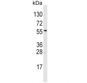 Western blot testing of human T-47D cell lysate with ALDH6A1 antibody. Predicted molecular weight: ~58 kDa.