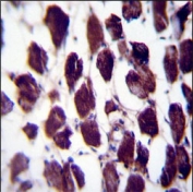 IHC testing of FFPE human skeletal muscle tissue with POLG antibody. HIER: steam section in pH6 citrate buffer for 20 min and allow to cool prior to staining.