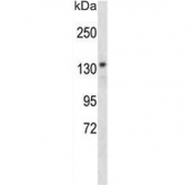 Western blot testing of mouse cerebellum lysate with POLG antibody. Predicted molecular weight ~140 kDa.