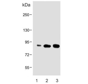 Western blot testing of human 1) Caki-1, 2) HeLa and 3) HepG2 cell lysate with ATG7 antibody. Predicted molecular weight: 70-80 kDa.