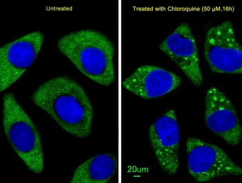 Immunofluorescent staining of treated and untreated human U-251 cells with ATG7 antibody (green) and DAPI nuclear stain (blue).