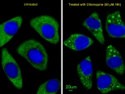 Immunofluorescent staining of treated and untreated human U-251 cells with ATG7 antibody (green) and DAPI nuclear stain (blue).