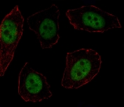 Immunofluorescent staining of fixed and permeabilized human U-251 cells with MSX1 antibody (green) and anti-Actin (red).