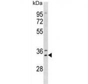 Western blot testing of human A375 lysate with MSX1 antibody. Predicted molecular weight ~31 kDa.