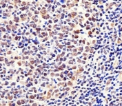 IHC testing of FFPE human tonsil tissue with Exportin 2 antibody. HIER: steam section in pH6 citrate buffer for 20 min and allow to cool prior to staining.