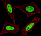 Immunofluorescent staining of human HeLa cells with Exportin 2 antibody (green) and anti-Actin (red).