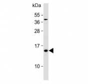 Western blot testing of human NCCIT cell lysate with HBE1 antibody. Predicted molecular weight ~16 kDa.