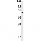 Western blot testing of human Y79 cell lysate with LYVE1 antibody. Expected molecular weight: 35-65 kDa depending on glycosylation level.