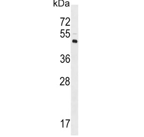 Western blot testing of human Y79 cell lysate with LYVE1 antibody. Expected molecular weight: 35-65 kDa depending on glycosylation level.