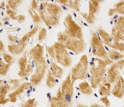 IHC testing of FFPE human heart tissue with Adenylate kinase 4 antibody. HIER: steam section in pH6 citrate buffer for 20 min and allow to cool prior to staining.