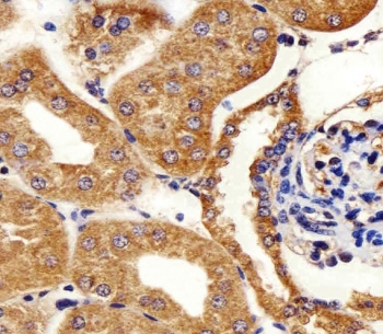 IHC testing of FFPE mouse kidney tissue with Adenylate kinase 4 antibody. HIER: steam section in pH6 citrate buffer for 20 min and allow to cool prior to staining.