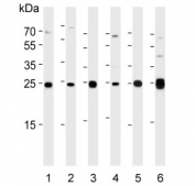 Western blot testing of human 1) A431, 2) HeLa, 3) HepG2, 4) MCF7, 5) Raji and 6) mouse kidney lysate with Adenylate kinase 4 antibody. Predicted molecular weight ~25 kDa.