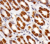 IHC testing of FFPE human stomach tissue with Cytochrome C1 antibody. HIER: steam section in pH6 citrate buffer for 20 min and allow to cool prior to staining.