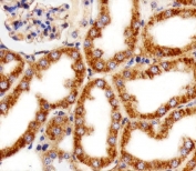 IHC testing of FFPE mouse kidney tissue with MPP7 antibody. HIER: steam section in pH6 citrate buffer for 20 min and allow to cool prior to staining.