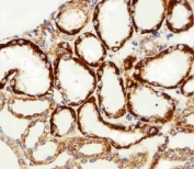 IHC testing of FFPE human kidney tissue with MPP7 antibody. HIER: steam section in pH6 citrate buffer for 20 min and allow to cool prior to staining.