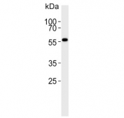 Western blot testing of human ovary lysate with MPP7 antibody. Predicted molecular weight ~66 kDa.