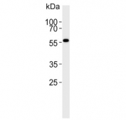 Western blot testing of human ovary lysate with MPP7 antibody. Predicted molecular weight ~66 kDa.