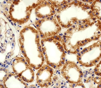 IHC testing of FFPE human kidney tissue with ADRA1D antibody. HIER: steam section in pH6 citrate buffer for 20 min and allow to cool prior to staining.