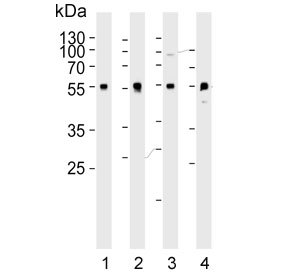 Western blot testing of human 1) A549, 2) LNCaP, 3) PC-3 and 4) rat brain lysate with ADRA1D antibody. Predicted molecular weight ~60 kDa.