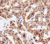 IHC testing of FFPE human liver tissue with AGAP4 antibody. HIER: steam section in pH6 citrate buffer for 20 min and allow to cool prior to staining.