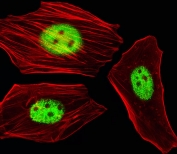 Immunofluorescent staining of fixed and permeabilized human HeLa cells with AGAP4 antibody (green) and anti-Actin (red).