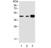 Western blot testing of 1) human 293, 2) human MOLT-4 and 3) mouse brain lysate with STRADA antibody. Predicted molecular weight ~48 kDa.