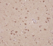 IHC testing of FFPE human brain tissue with STRADA antibody. HIER: steam section in pH6 citrate buffer for 20 min and allow to cool prior to staining.
