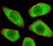 Immunofluorescent staining of human A549 cells with STRADA antibody (green) and anti-Actin (red).